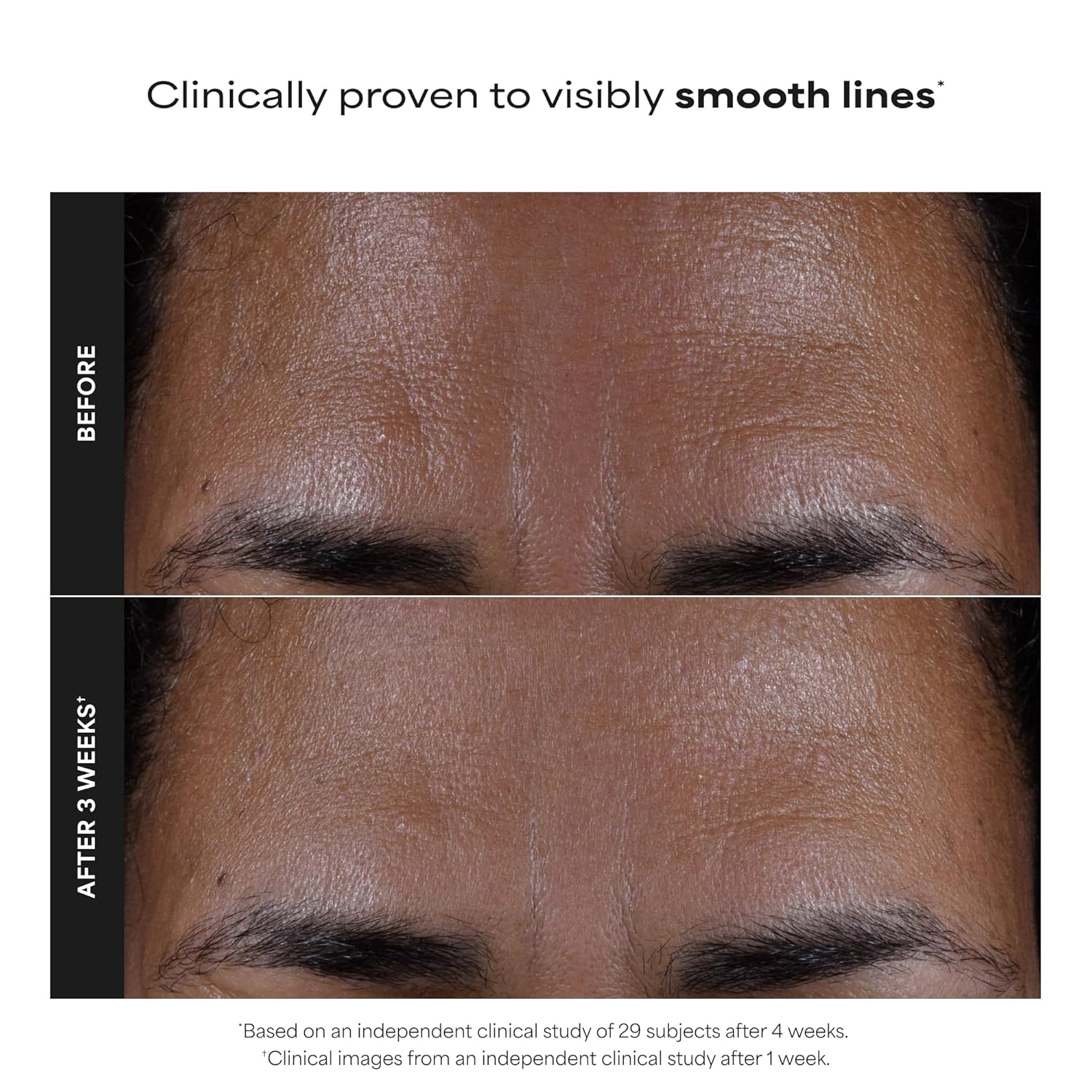 Paula's Choice SKIN PERFECTING 2% BHA Liquid Exfoliant with Salicylic Acid, Facial Polish for Pores, Wrinkles & Fine Lines, Suitable for Blackhead-Prone Skin, Fragrance-Free